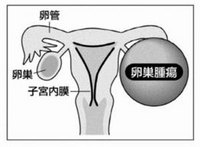 産婦人科疾患 徳島県医師会webサイト